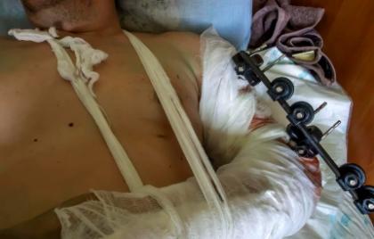 Реабилитационные центры после операции